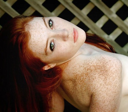 Redheads, Pale Skin and Freckles